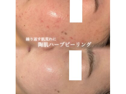 celeria【セレリア】 【11月中旬 NEW OPEN(予定)】の写真