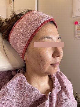 リフティングラボ(LIFTING LAB)/ビーナスディーバ