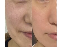 アイクイーン 亀戸(Eyequeen)/