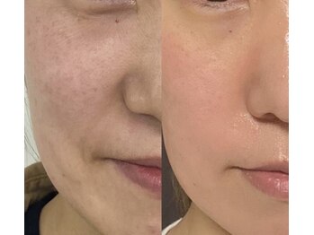 アイクイーン 亀戸(Eyequeen)/