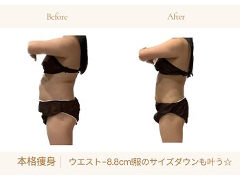 アランルージュ(ALANROUGE)/劇的★ビフォーアフター