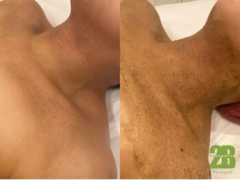 ナンバー19(N°19)/2Bバイオトリートメント