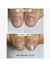 自爪育成・最強のネイルケア鳥取