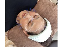 アキュリス(aquliss)