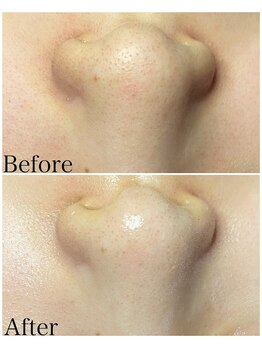 ブラックボックス(BLACK BOX)/20代女性のお客様