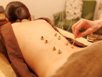 うずまきはり灸治療院/お灸の様子