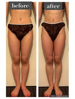 マンダ 田町(Manda)/足の痩身もおまかせください♪