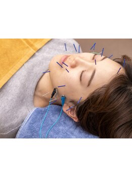 鍼灸施術を受けたい