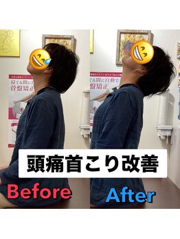 ヒデ整体院(Hide整体院)/猫背矯正骨盤矯正B/A肩こり腰痛