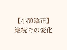リン 吉祥寺店(Rin)/小顔矯正ビフォーアフター