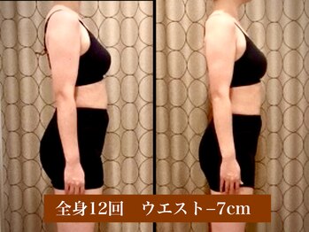 サロン セドナ(SALON SEDONA)/全身リンパ痩身コース 12回