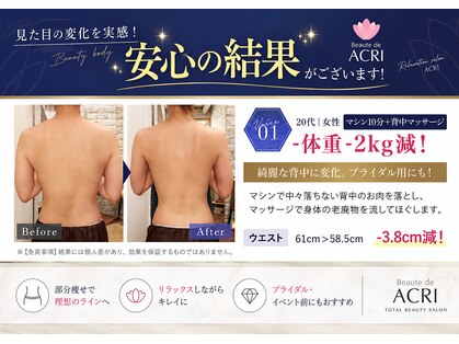 ボーテドアクリ 元町店(Beaute de ACRI)の写真