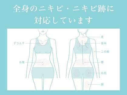 オリス 名古屋店(oliss)の写真