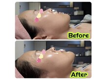 ユソン(YSN)の雰囲気（高周波RFサーマトリックスでの小顔施術おススメです）