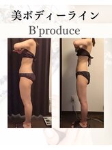 ビープロデュース 亀有店(B’PRODUCE)/Before &after