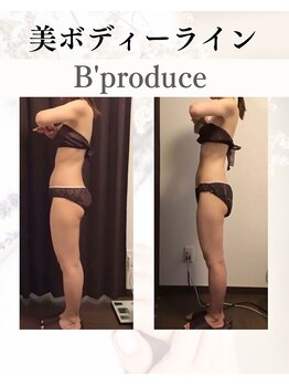ビープロデュース 亀有店(B’PRODUCE)/Before &after