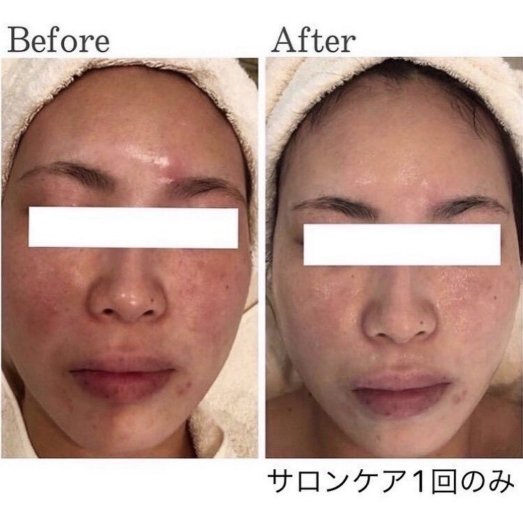 エラフリー｜ホットペッパービューティー