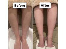 ミュリール 根津店(Murir)/スクラブ付きフットバスもご用意