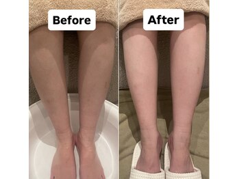 ミュリール 根津店(Murir)/スクラブ付きフットバスもご用意