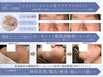 フレイヤ(FREYA)の写真