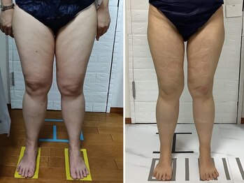 ビューティフルムーン(Beautiful Moon)/冷却1撃コース♪