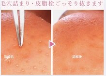 モミン(MOMI.N)
