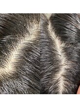 シュール センター南(SURREAL)/ヘッドスパ後のビフォーアフター