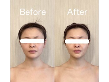 サロン ド シャルール/GROTTY一回の施術結果