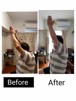 アース エンジェル整体院/ビフォアフ　肩こり　ストレッチ