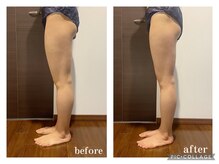 コリー(QOLy)/インディバボディ