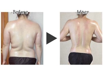 サロン ド チョコ(SALON DU CHOCO)/痩身全身