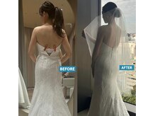 オンディーヌ 名古屋/劇的に!!エステ通いは短期に卒業