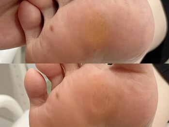 キラネイル アンド アイラッシュ by World Beauty(KIRA)/新潟 フットケア