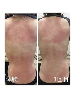 ムーン(MOON)/トーンヌールご体験のお客様