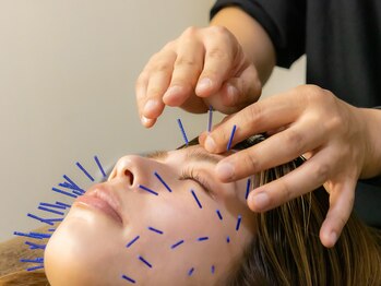 ボニー(Bonnie)/【美容鍼灸】