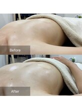 ルミエール(Lumiere)/【倉敷市】バストアップ施術事例