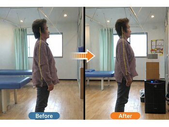 しんぐう整体院/歩行時のしびれ改善 80代女性