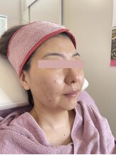 リフティングラボ(LIFTING LAB)/ビーナスディーバ