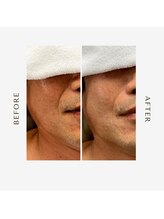 オーシャン(OCEAN)/当サロン人気メニュー　ムートン