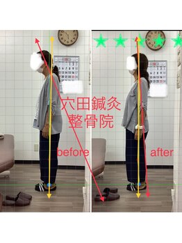 穴田鍼灸整骨院/整体・骨盤・ねこぜ・まき肩矯正