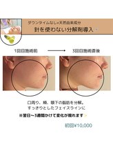 ミーカラー(mecalla.)/レモンボトルBA