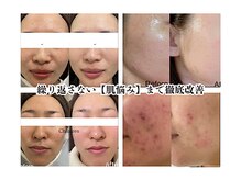 シャルトルズ 西宮北口店の雰囲気(終わりのあるケアをご提案。専門のスタッフにお任せください)