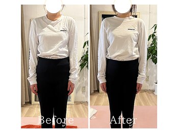 アップライフギャラリー(UP LIFE GALLERY)/ピラティスBefore→After