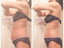 ニコルビー(Nicole Bee)/ウエスト