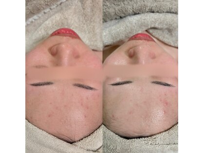 オンド(OND)の写真