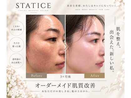 スターティス(STATICE)の写真