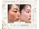 スターティス(STATICE)の写真