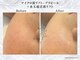ポムハヌル 大阪梅田(pom.haneul)の写真