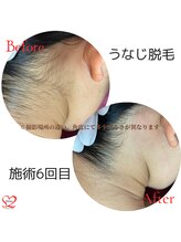 オリオンドットエスツー(Orion.S2)/【Before→After】