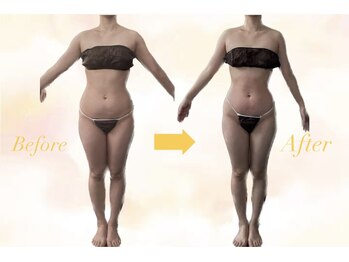 ノエル(NOEL)/10回/3ヶ月での効果